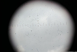 Ďalekohľad, je to vojna?